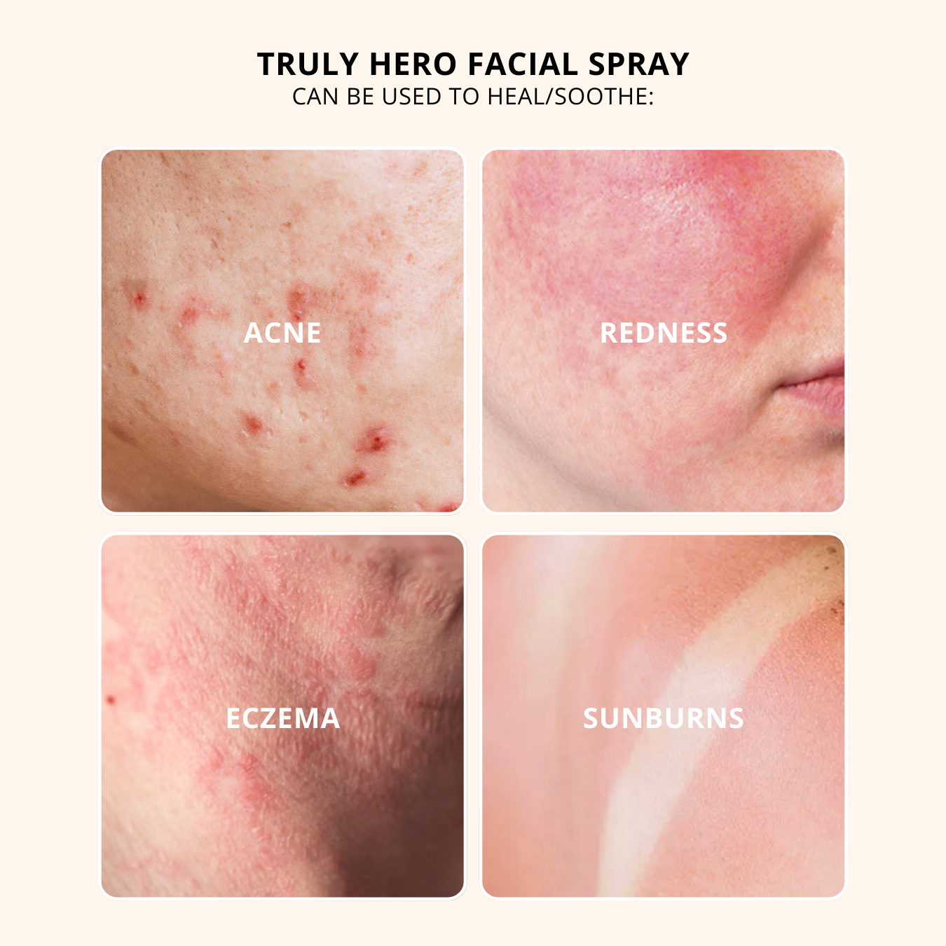 Truly Hero Facial Spray Refill